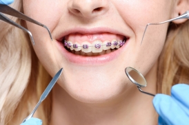 Ortodontik Sabit Tedaviye Başladıktan Sonra Dikkat Edilmesi Gereken Konular