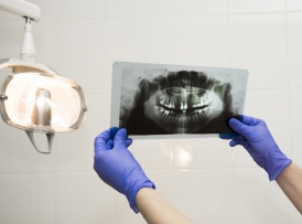 Endodontik Tedavi Sonrasında Dikkat Edilmesi Gereken Konular