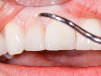 Periodontoloji